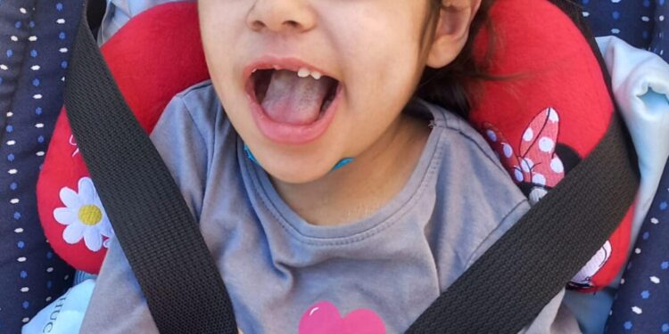 Amigos promovem concerto solidário em Avô para ajudar a pequena Luna, de 5 anos, vítima de paralisia cerebral